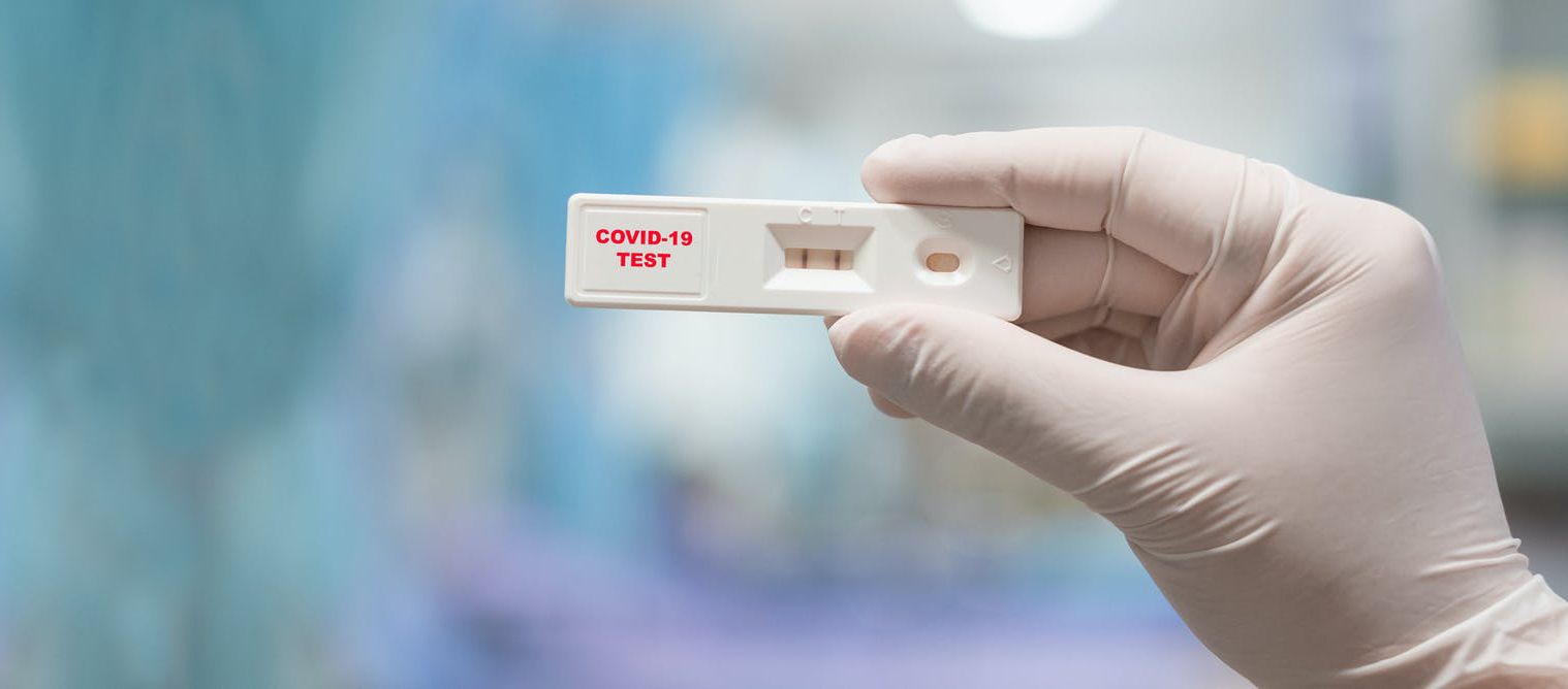  Per fer-se et test no cal cita prèvia i l'horari és de dilluns a divendres de 9.00 h a 13.00 h i de 15.00 h a 19.00 h. FOTO: Cedida