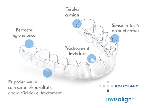 ortodoncia invisible invisalign GRUP POLICLINIC ortodoncia invisible invisalign GRUP POLICLINIC